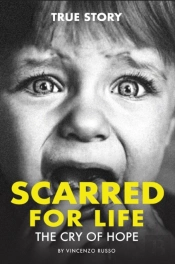 Scarred For Life