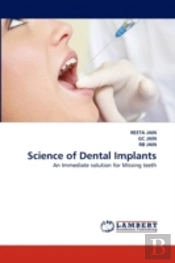 Science Of Dental Implants
