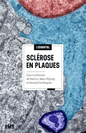 Sclerose En Plaques