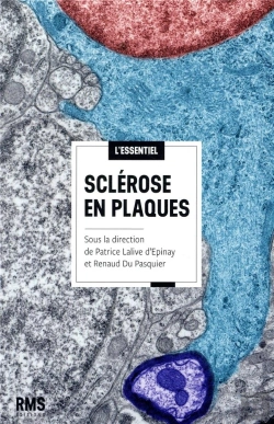 Bertrand.pt - Sclerose En Plaques