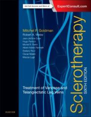 Sclerotherapy