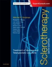 Sclerotherapy