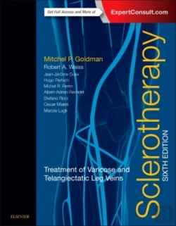 Bertrand.pt - Sclerotherapy