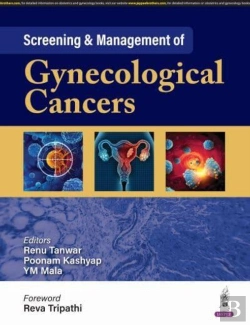 Bertrand.pt - Screening & Management Of Gynecological Cancers
