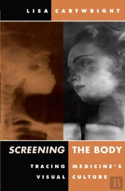 Bertrand.pt - Screening The Body