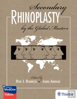 Bertrand.pt - Secondary Rhinoplasty By The Global Masters