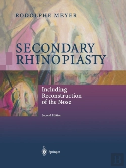 Bertrand.pt - Secondary Rhinoplasty