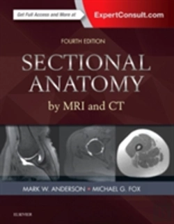 Bertrand.pt - Sectional Anatomy By Mri And Ct
