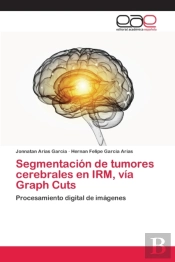 Segmentacion De Tumores Cerebrales En Irm, Via Graph Cuts