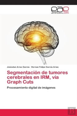 Bertrand.pt - Segmentacion De Tumores Cerebrales En Irm, Via Graph Cuts