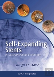Self-Expanding Stents In Gastrointestinal Endoscopy