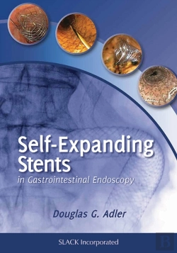 Bertrand.pt - Self-Expanding Stents In Gastrointestinal Endoscopy
