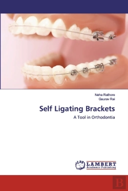 Bertrand.pt - Self Ligating Brackets