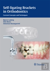 Self-Ligating Brackets In Orthodontics