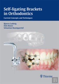 Bertrand.pt - Self-Ligating Brackets In Orthodontics