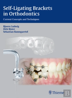 Bertrand.pt - Self-Ligating Brackets In Orthodontics
