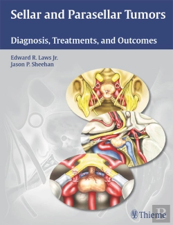 Bertrand.pt - Sellar And Parasellar Tumors