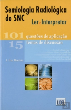 Bertrand.pt - Semiologia Radiológica do SNC