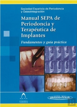 Bertrand.pt - Sepa:Manual Periodoncia Y Osteointegr.
