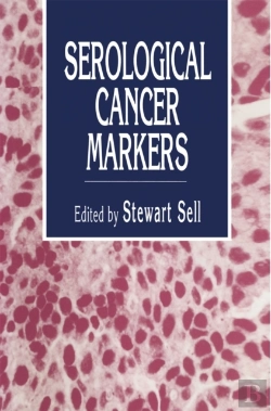 Bertrand.pt - Serological Cancer Markers