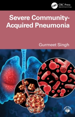 Bertrand.pt - Severe Community-Acquired Pneumonia