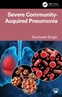 Bertrand.pt - Severe Community-Acquired Pneumonia