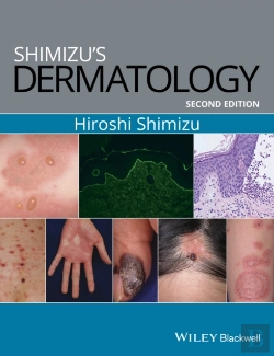 Bertrand.pt - Shimizu'S Dermatology