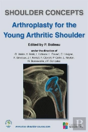 Shoulder Concepts Arthroplasty For The Young Arthritic Shoulder
