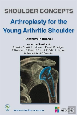 Bertrand.pt - Shoulder Concepts Arthroplasty For The Young Arthritic Shoulder