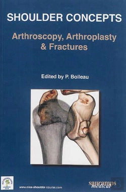 Bertrand.pt - Shoulder Concepts- Arthroscopie, Arthroplasty & Fractures 2014