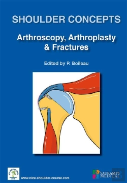 Bertrand.pt - Shoulder Concepts Arthroscopy Arthrosplasty & Fractures
