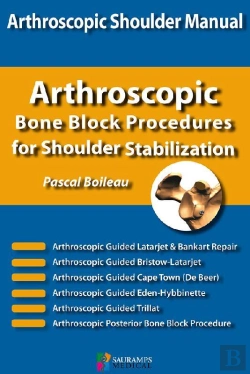 Bertrand.pt - Shoulder Concepts Bon Block Procedures For Shoulder Stabilization
