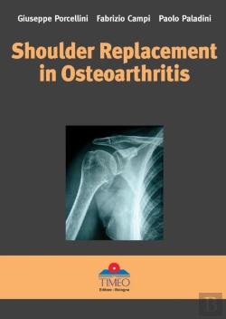 Bertrand.pt - Shoulder Replacement In Osteoarthritis
