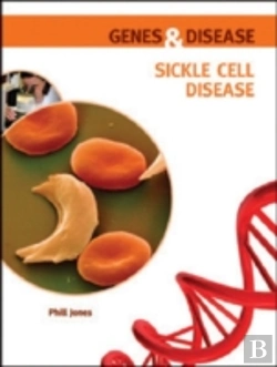 Bertrand.pt - Sickle Cell Disease