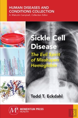 Bertrand.pt - Sickle Cell Disease