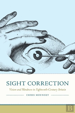 Bertrand.pt - Sight Correction