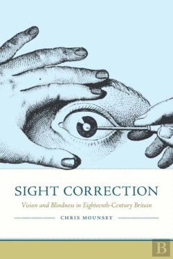 Bertrand.pt - Sight Correction
