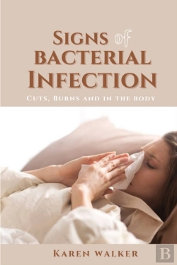Bertrand.pt - Signs Of Bacterial Infection