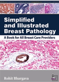 Bertrand.pt - Simplified And Illustrated Breast Pathology