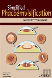 Simplified Phacoemulsification