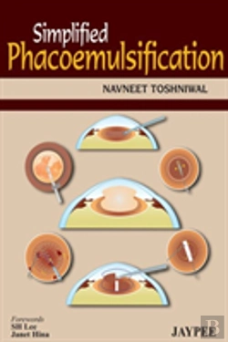 Bertrand.pt - Simplified Phacoemulsification