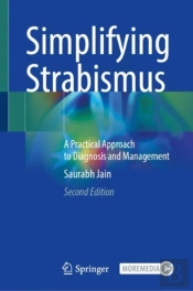 Simplifying Strabismus