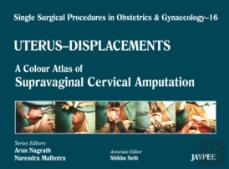 Single Surgical Procedures In Obstetrics And Gynaecology - Volume 16 - Uterus - Displacements