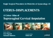 Single Surgical Procedures In Obstetrics And Gynaecology - Volume 16 - Uterus - Displacements