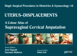 Bertrand.pt - Single Surgical Procedures In Obstetrics And Gynaecology - Volume 16 - Uterus - Displacements