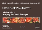 Single Surgical Procedures In Obstetrics And Gynaecology - Volume 20 - Uterus - Displacements