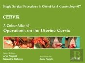 Single Surgical Procedures In Obstetrics And Gynaecology - Volume 7 - Cervix - A Colour Atlas Of Operations On The Uterine Cervix