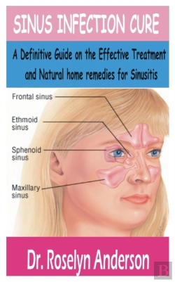 Bertrand.pt - Sinus Infection Cure