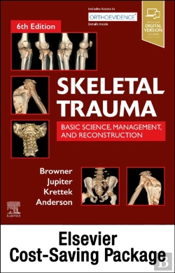 Bertrand.pt - Skeletal Trauma (2-Volume) And Green'S Skeletal Trauma In Children Package