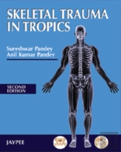 Skeletal Trauma In Tropics